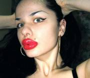 100 Lip Injections To Look Like Jessica Rabbit