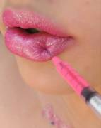 Diy Injected Lips!