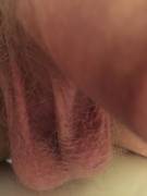 Album For Freedom (; (Pms Welcome)