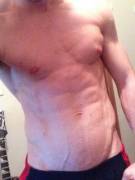 Second V Post (Ab Veins)