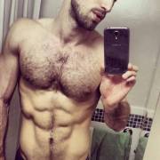 You Guys Convinced Me To Keep My &Amp;Quot;Fuzz&Amp;Quot;