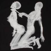 Who Would Have Expected A Crosspost From /R/Interestingasfuck?