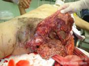 Up Close And Personal, Unshaven [F]