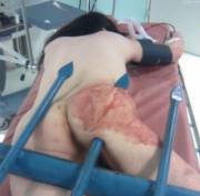 Tried The New Sex Position And [F]Ailed. Halp?