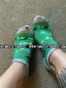 Poked A Hole In My Ankle Socks!