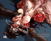 Mei Got Sawed [Overwatch]