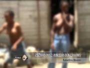 Three Boys From The Dominican Republic Developed Large Woman Like Breasts During ...