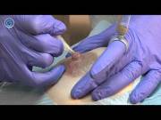 Micropigmentation - Nipple Rejuvenated 0:12