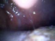 Video Of Woman Swallowing Camera. Awesome Youtube Channel. Must Have An Account To ...